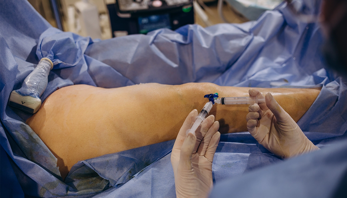 SKLEROTERAPİ İLE VARİS TEDAVİSİ